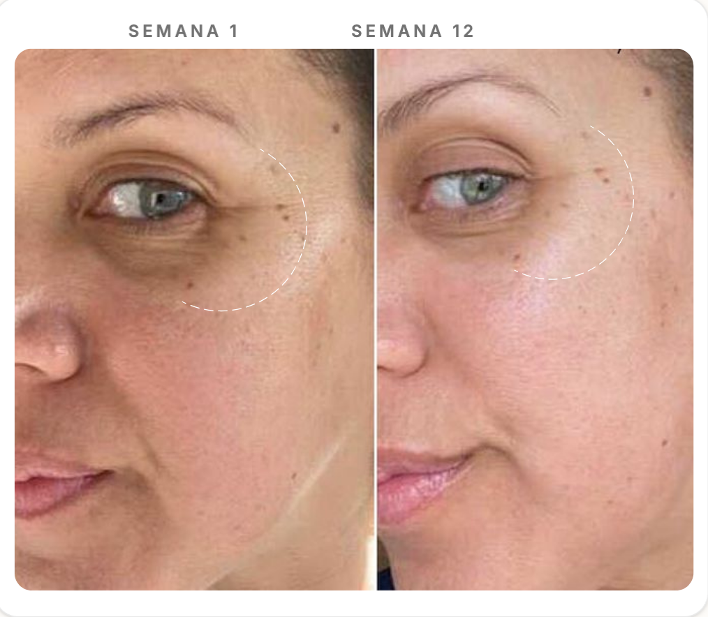 Comparação Semana 1 e Semana 12 — Uniformização & Manchas Solares